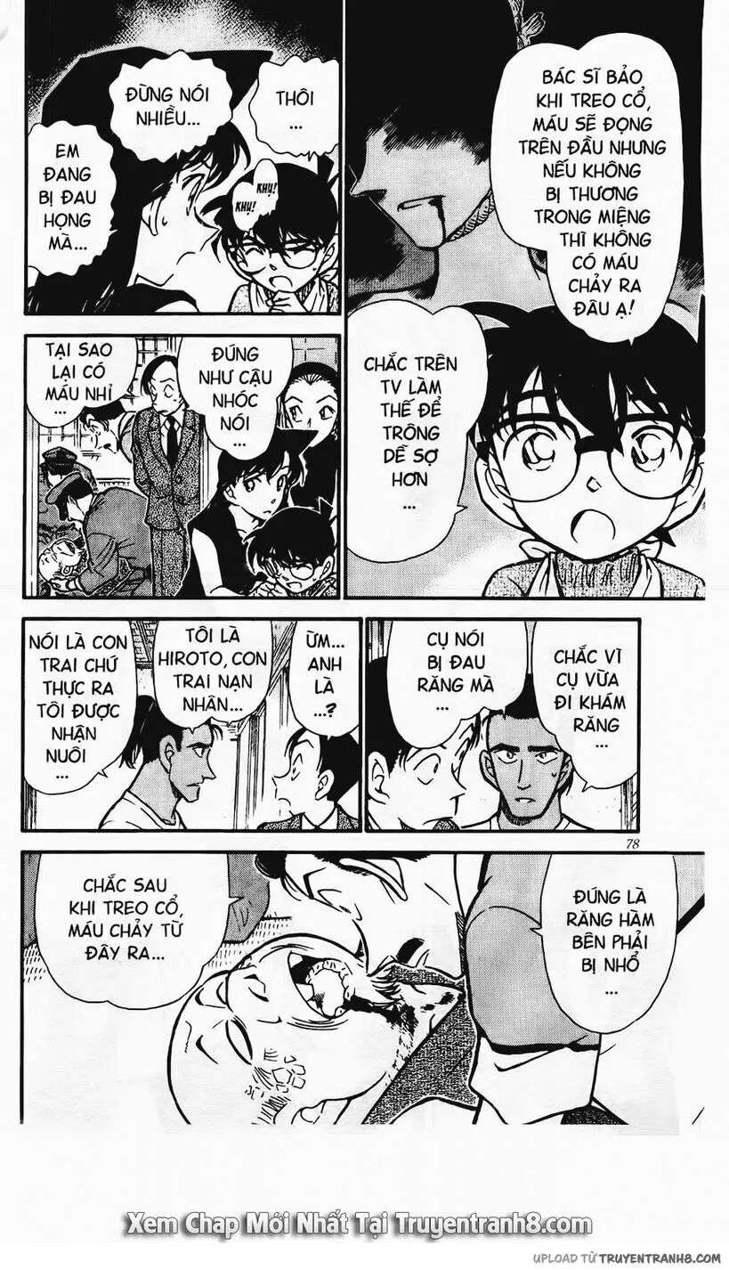 Conan - Chương 408