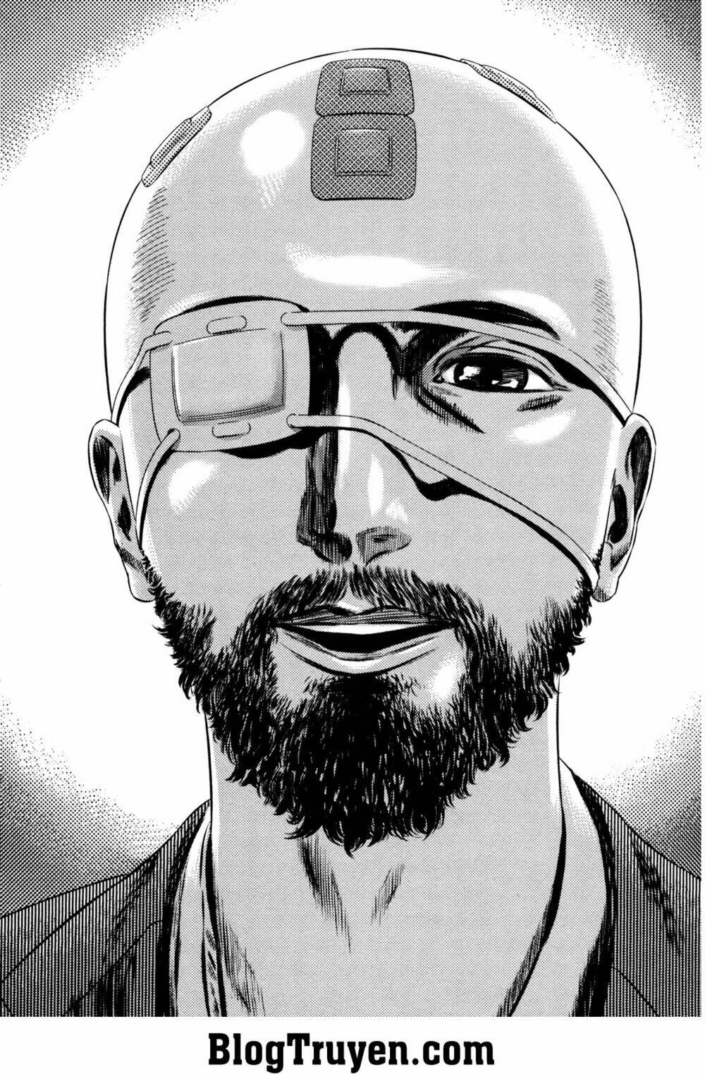 Homunculus - Chương 158