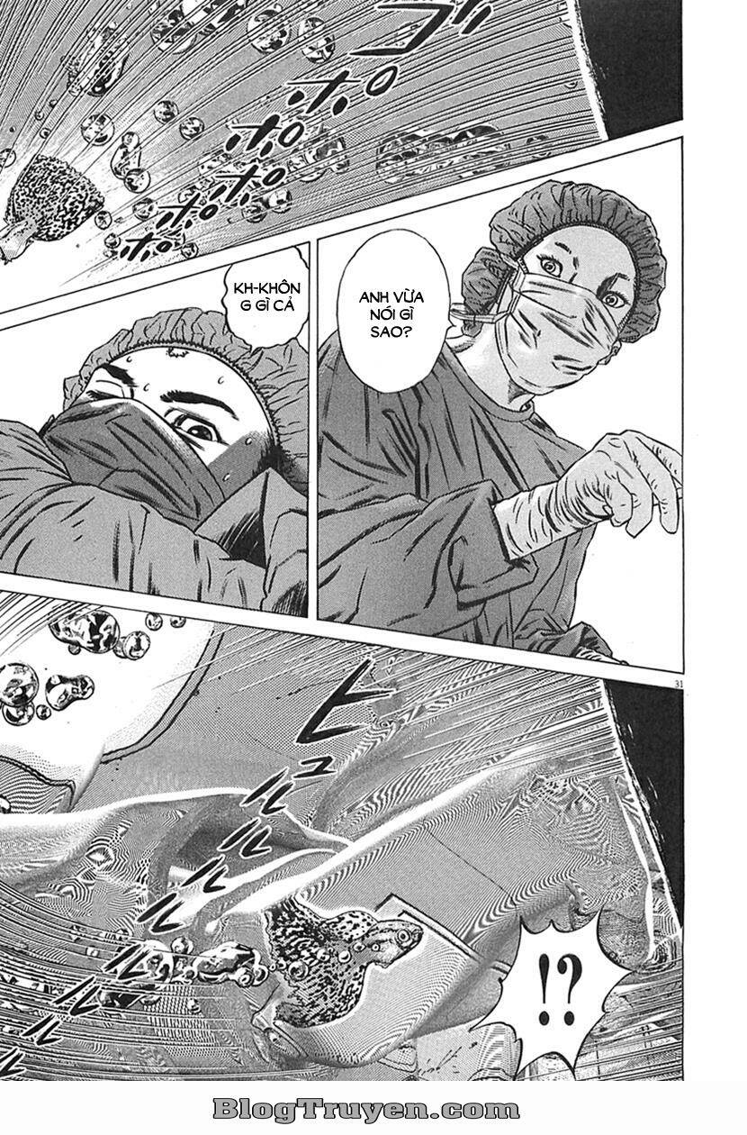 Homunculus - Chương 63