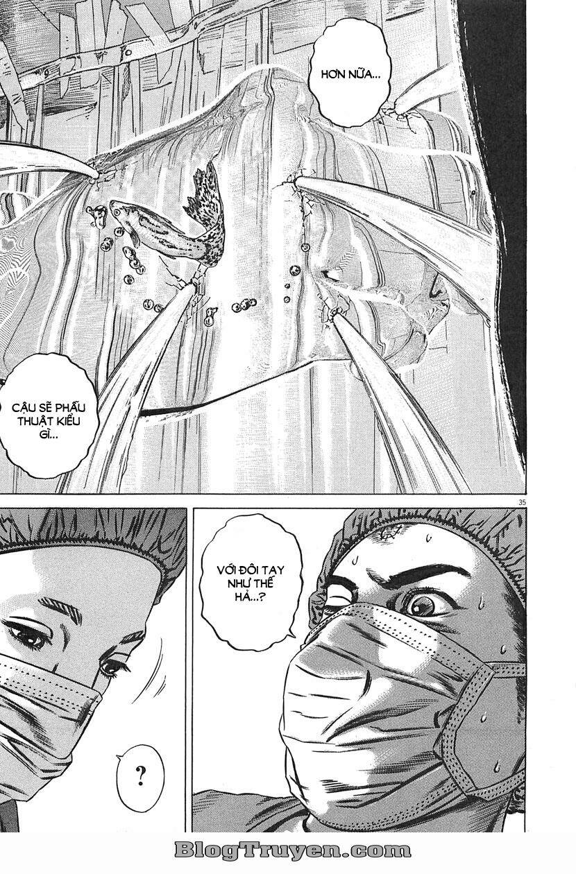 Homunculus - Chương 63