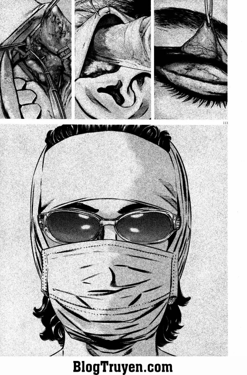 Homunculus - Chương 76