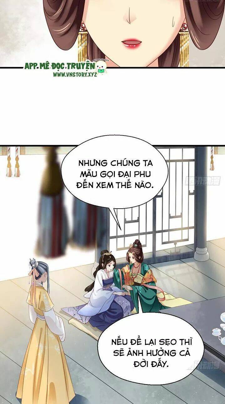 Kiều Nữ Độc Phi - Chương 169